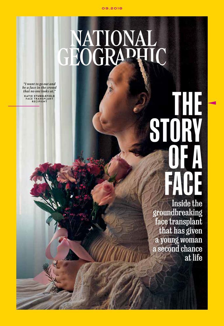 National Geographic cover of a face transplant recipient