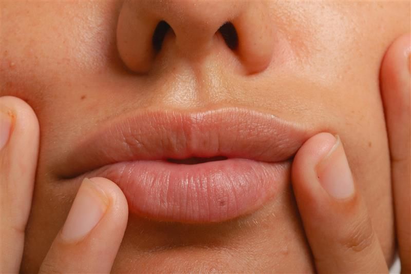 How to Get Rid of Perioral Dermatitis, According to Dermatologists