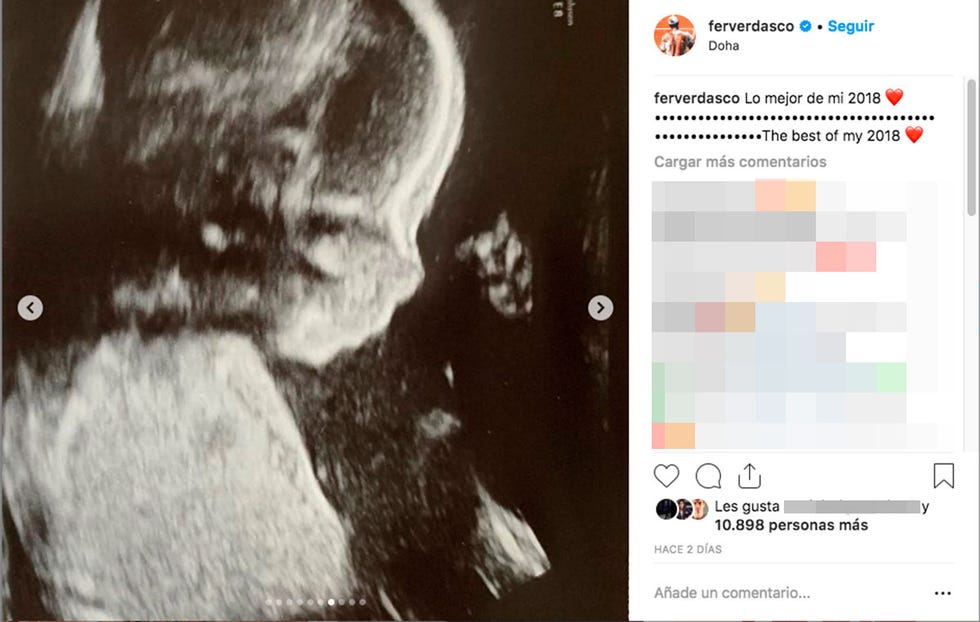 Fernando Verdasco comparte la primera ecografía de su hijo
