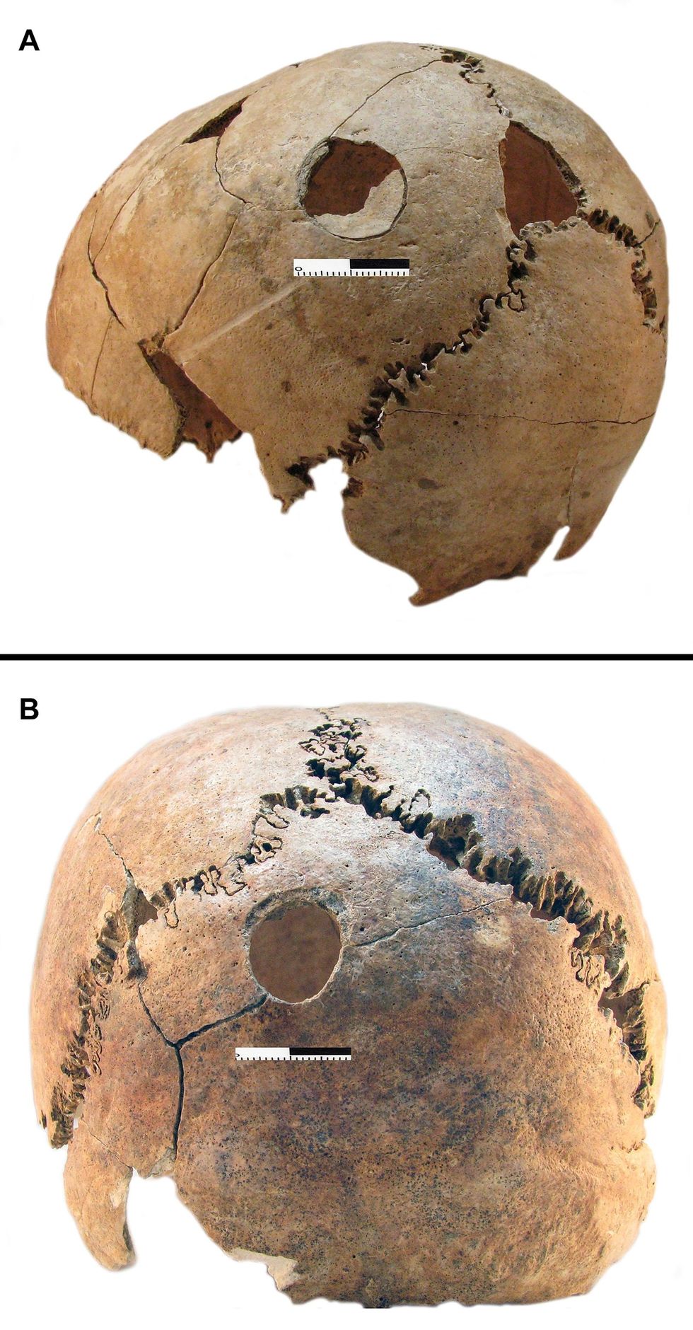 Archeologen constateerden de dodelijke inwerking van stompe voorwerpen op de schedels van een jongen boven en een jonge vrouw onder