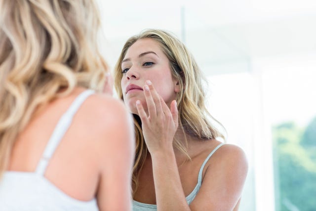 How to treat acne scars