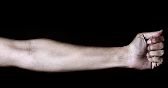 Предплечье мужчина. Forearm. Forearm where. Female forearm. Arm and forearm.