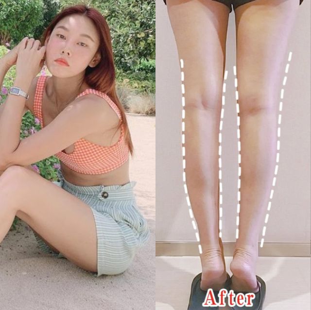 韓網瘋傳10個超簡單瘦腿運動！浮腫象腿、蘿蔔全都能瘦成細腿