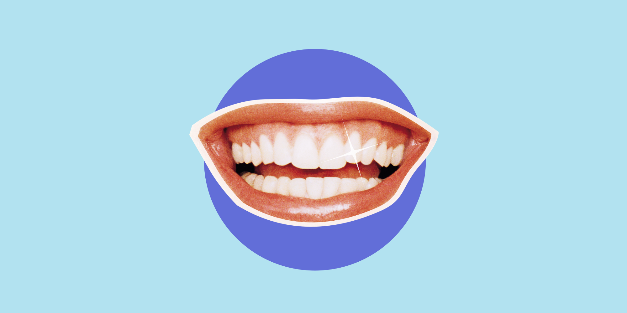 Composite bonding vs veneers: costs and which is best for teeth?
