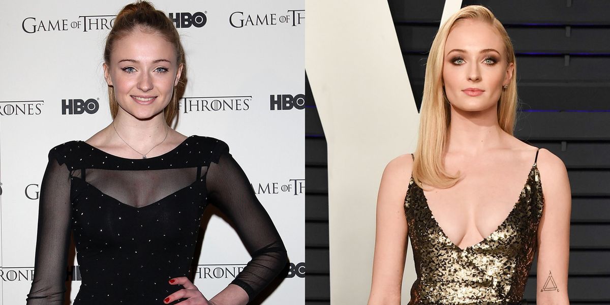 Game Of Thrones': What The Cast Looked Like In Season 1 vs. Now