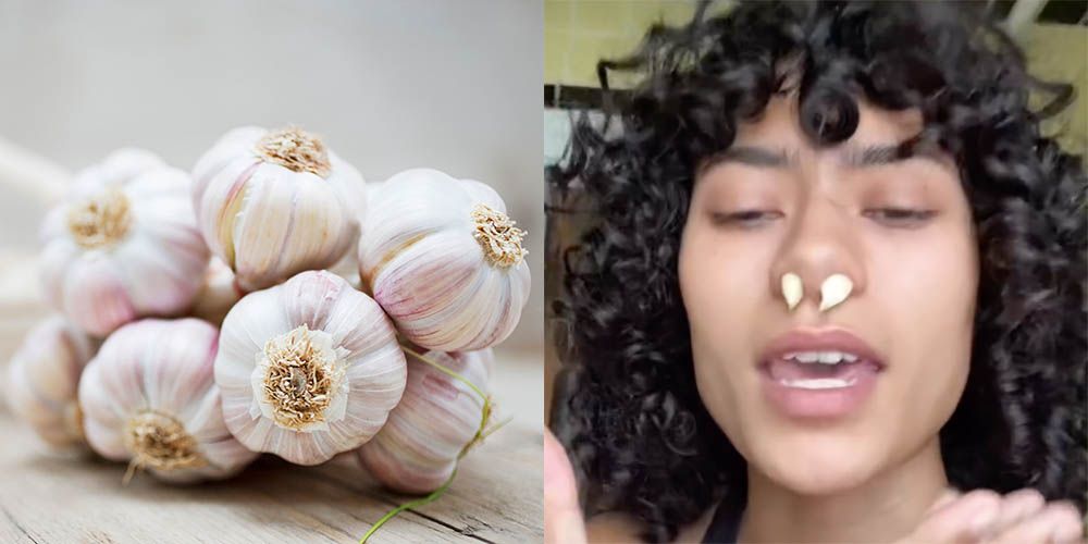 Garlic Should Not Be Put Up Your Nose, According To A Doctor