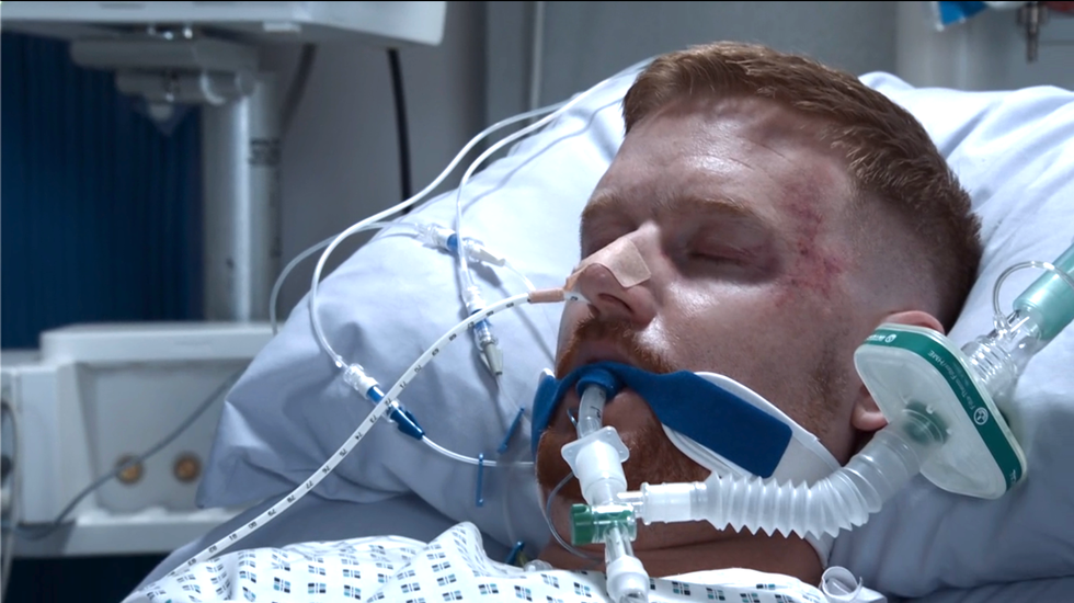 a closeup of gary windass as he lies unconscious in a hospital bed, coronation street