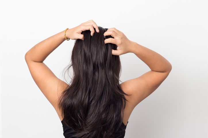 women itching scalp damaged hair, haircare concept