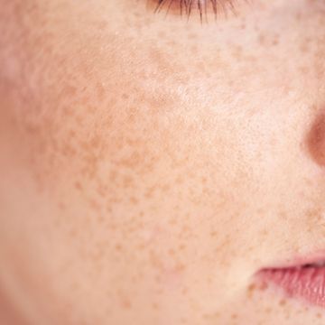 Cropped Image Of Woman With Freckles On Face