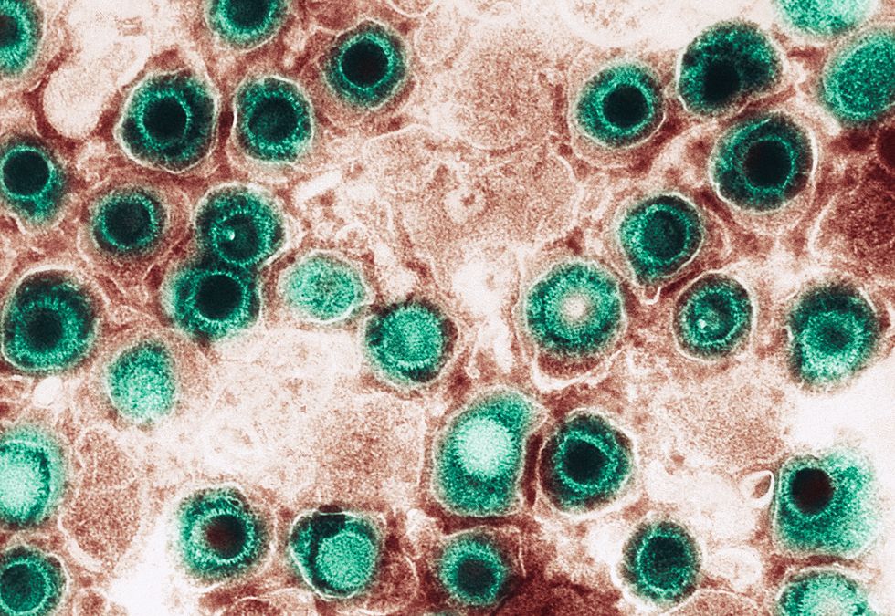 electron micrograph, herpes virus