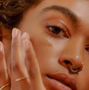 acne-scars acne scars