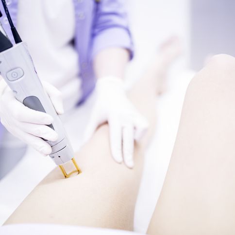 young woman getting laser hair removal treatment on leg, close up