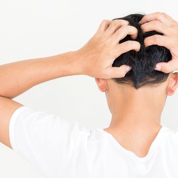 young man suffering from itching him head, itching scalp