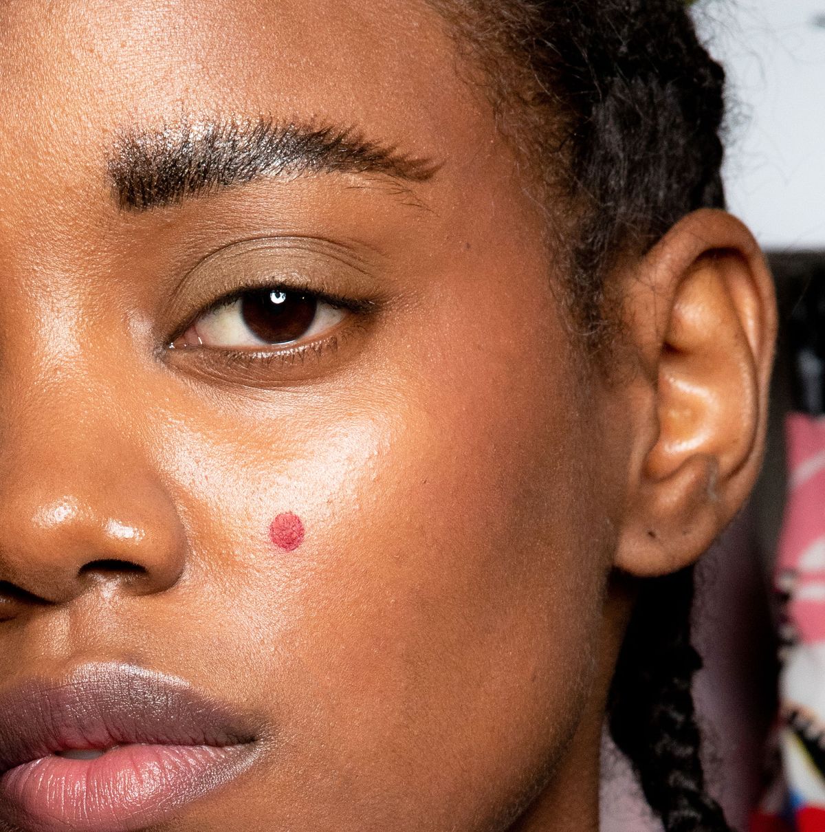 How to Get Rid of Pimples Fast in 2024: 9 Expert Acne Tips