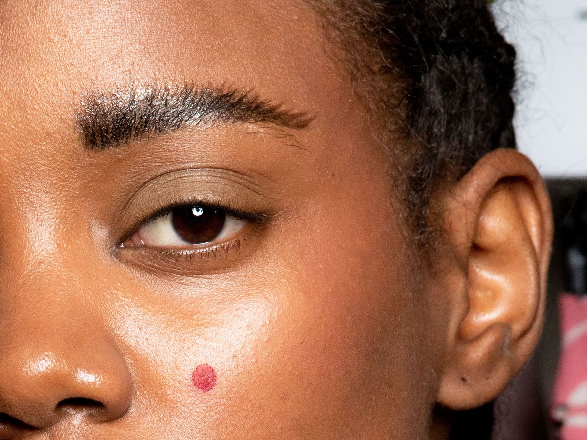 Home Remedies To Remove Dark Spots on the Face Overnight Naturally?