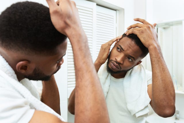 Baldness cure discount