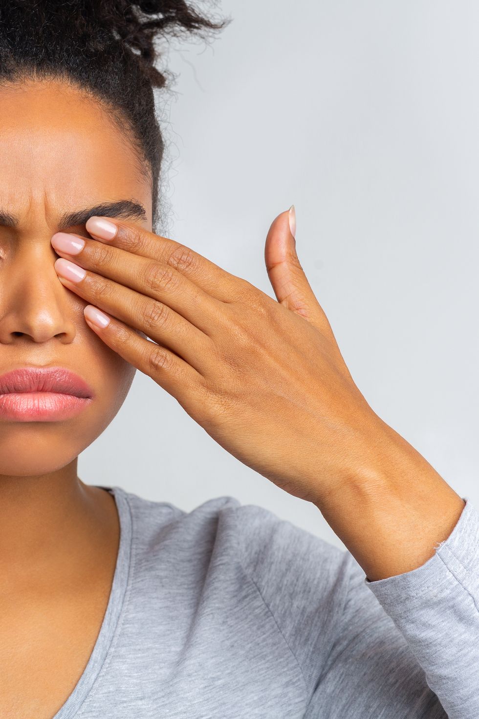 african girl rubs her eye, suffering from conjunctivitis, ocular diseases concept