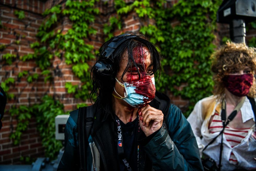 a journalist is seen bleeding after police started firing tear gas and rubber bullets near the 5th police precinct following a demonstration to call for justice for george floyd, a black man who died while in custody of the minneapolis police, on may 30, 2020 in minneapolis, minnesota   clashes broke out and major cities imposed curfews as america began another night of unrest saturday with angry demonstrators ignoring warnings from president donald trump that his government would stop violent protests over police brutality cold photo by chandan khanna  afp photo by chandan khannaafp via getty images