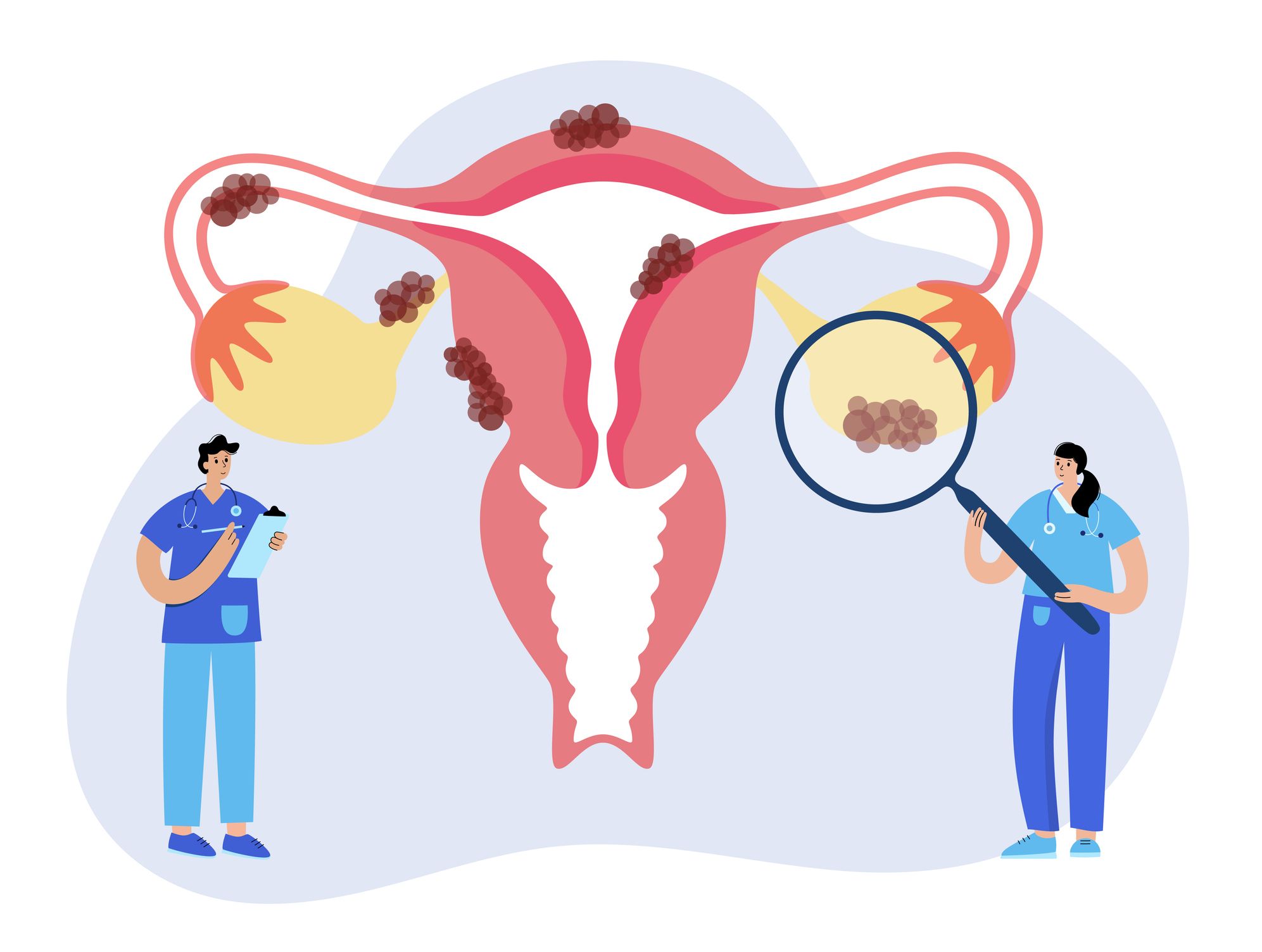 uterus anatomy, endometriosis cancer and tumor disease woman health medicine doctor gynecologist appointment, consultation, help, treatment female reproductive system flat vector illustration