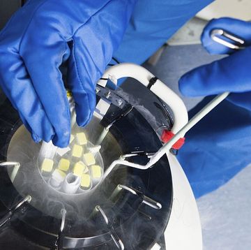 doctors hands removing embryo samples from cryogenic storage, fertilized embryos are stored in liquid nitrogen filled tanks to keep them as new if patients require them at a later date photo by universal images group via getty images