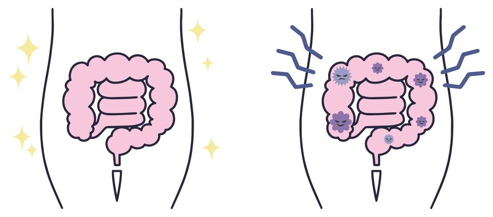 intestinal activity intestines simple illustration