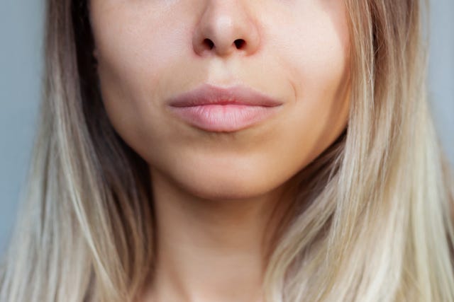 How to Restore Facial Fat After Buccal Fat Removal, According to Experts