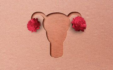 endometriosis