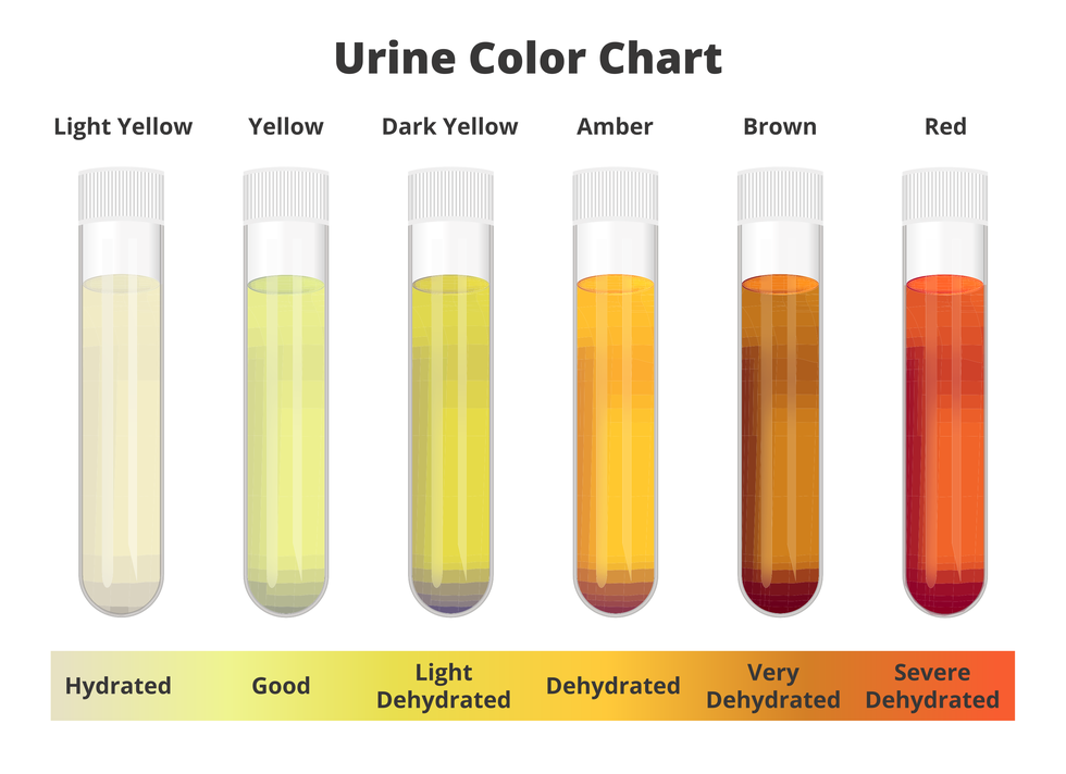urinalysis, drug testing, drug plastic jars for medical tests urine test