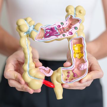 woman holding human colon anatomy model colonic disease, large intestine, colorectal cancer, ulcerative colitis, diverticulitis, irritable bowel syndrome, digestive system and health concept