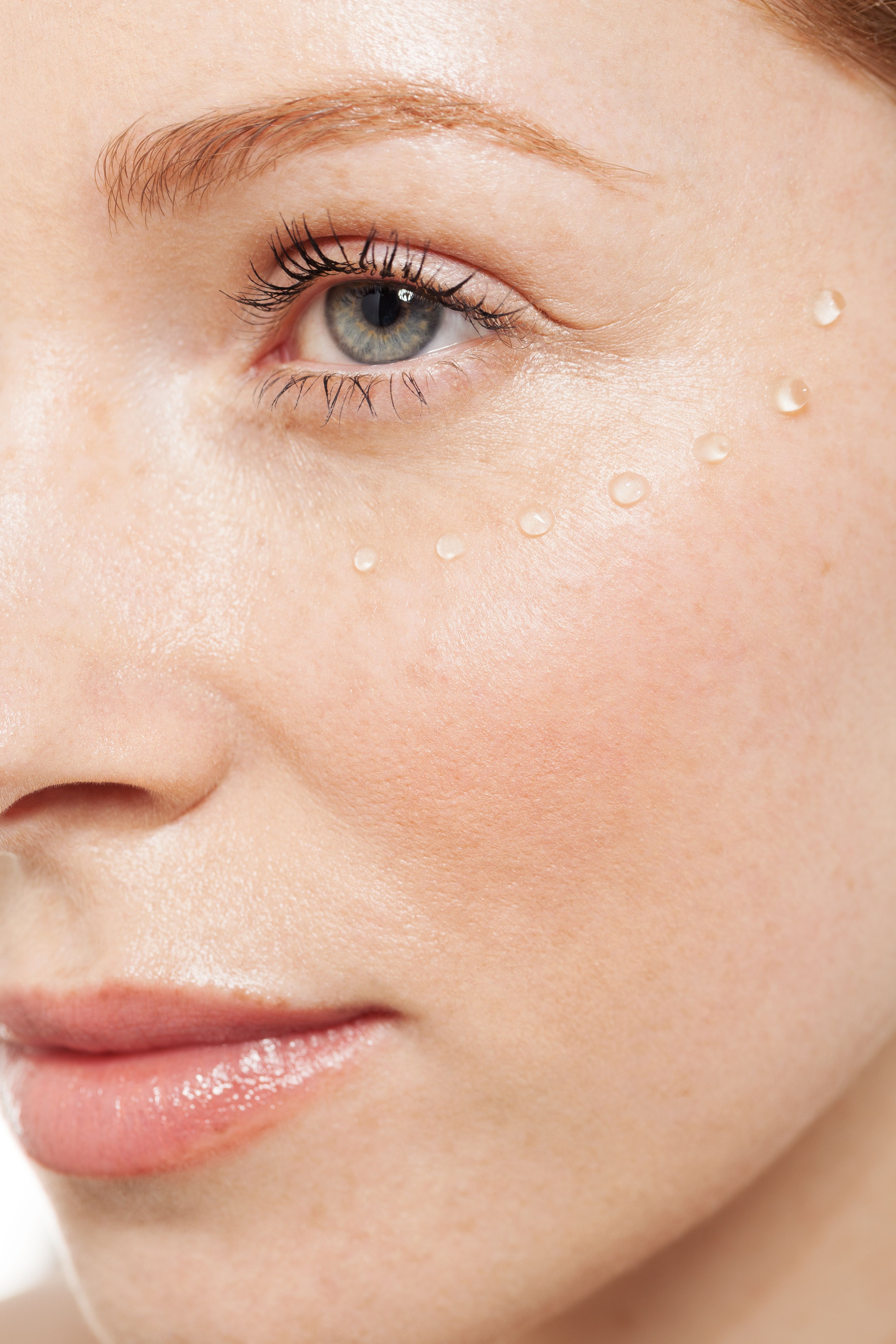 Dry Eyelids Causes And Remes