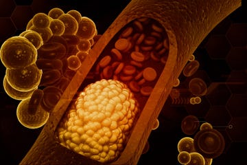 zo werkt cholesterol