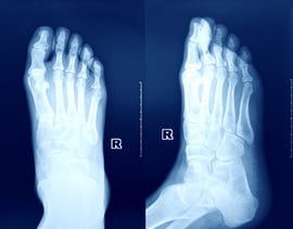 x ray image of the foot