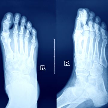 x ray image of the foot