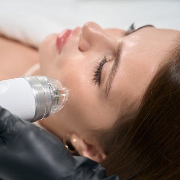 rf microneedling review rf microneedling review