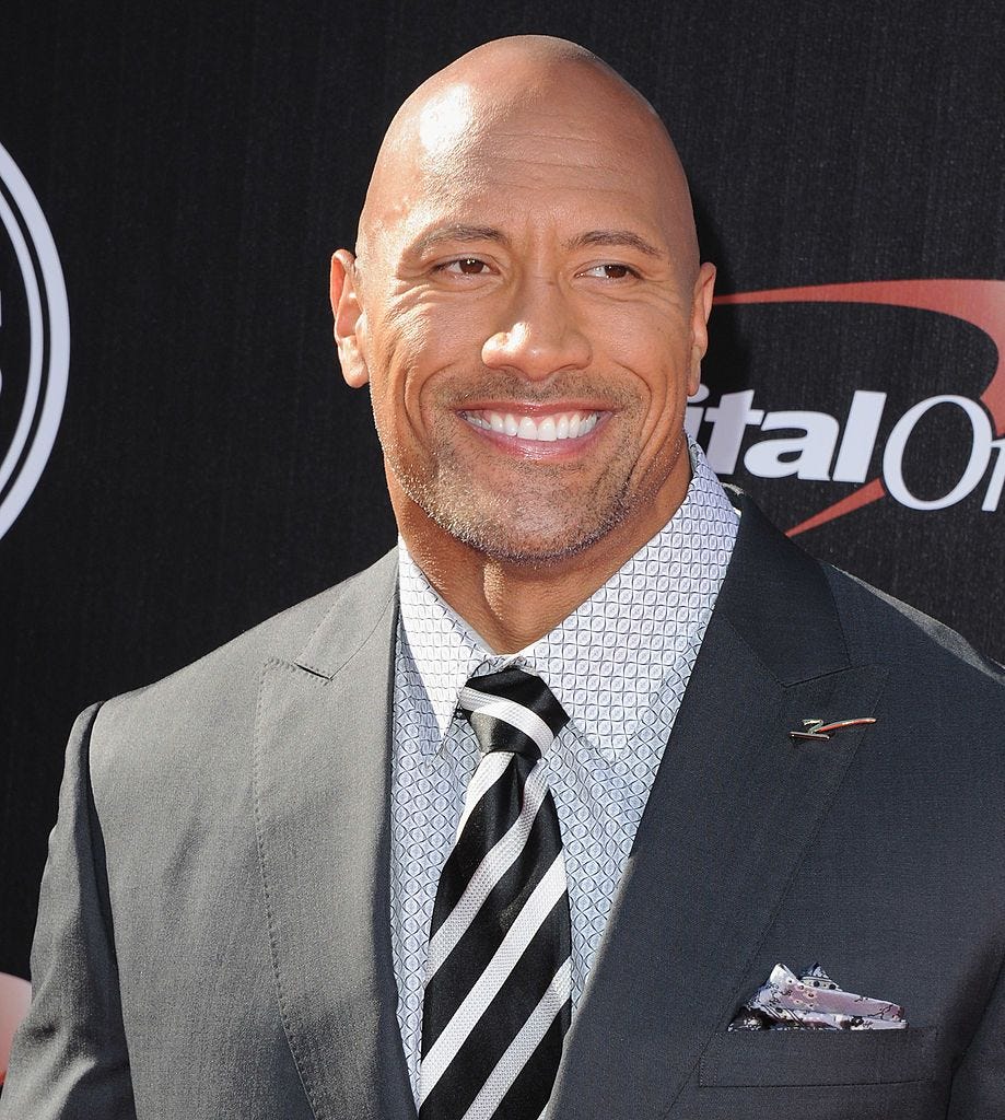 Balding celebs