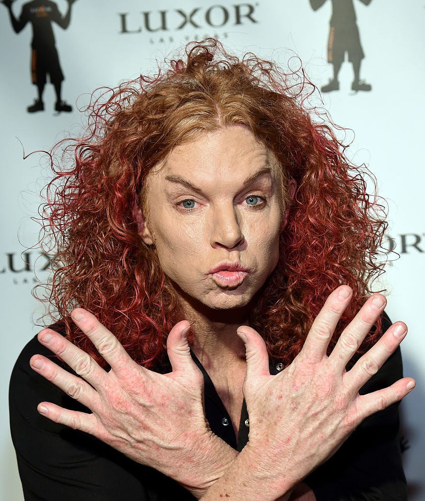 Ugliest hair a celeb has ever had