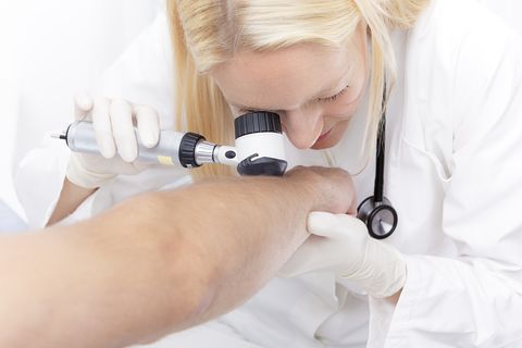Dermatologists Skin Cancer Screening