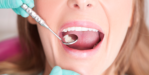 woman having teeth examined by dentist