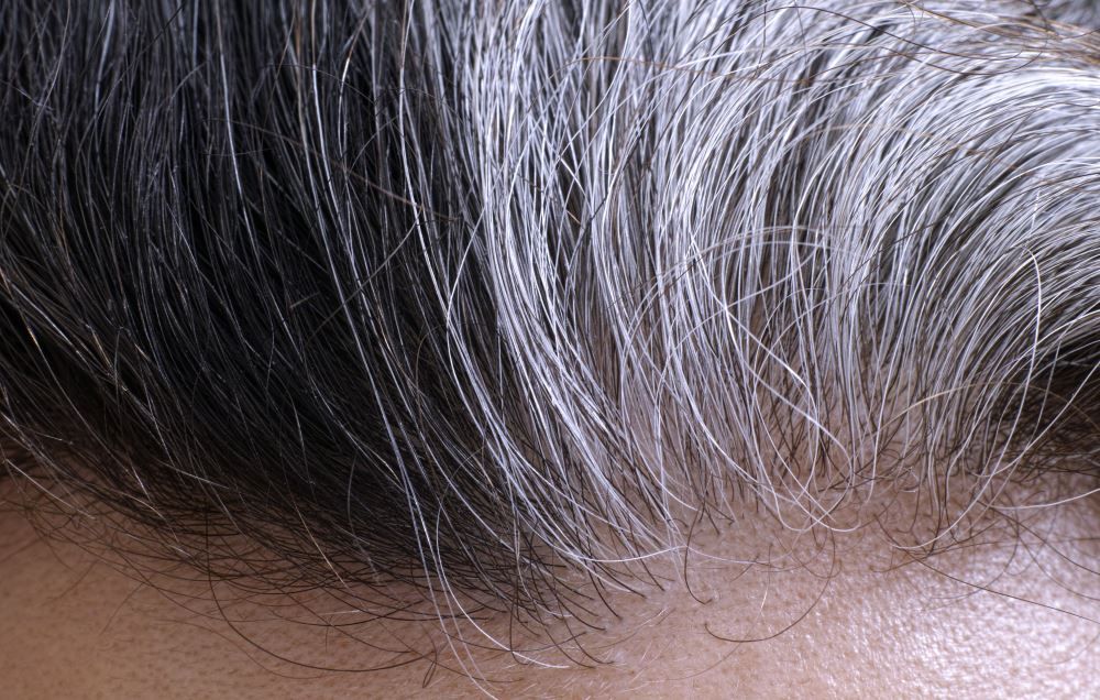 6 Ways To Fix Your Gray Roots Without Dye | Prevention