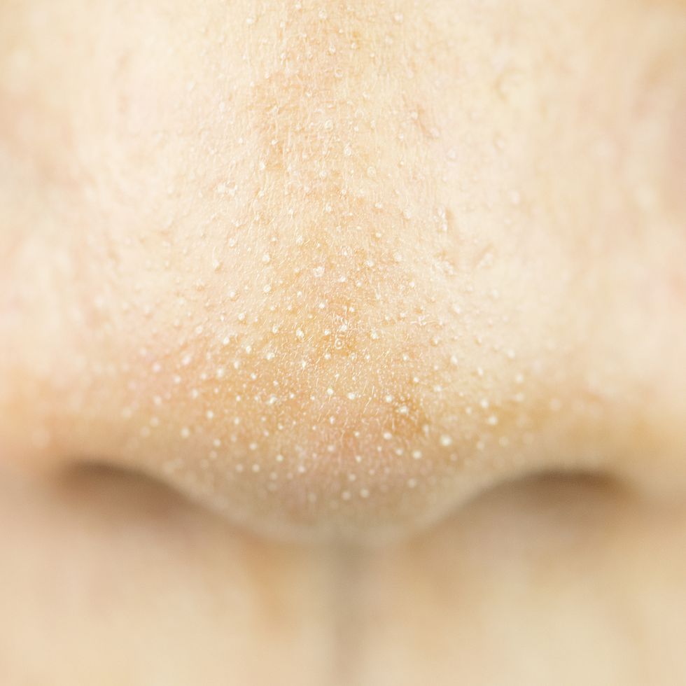 Skin, Nose, Close-up, Lip, Material property, Neck, Mouth, Beige, Jaw, Tooth, 