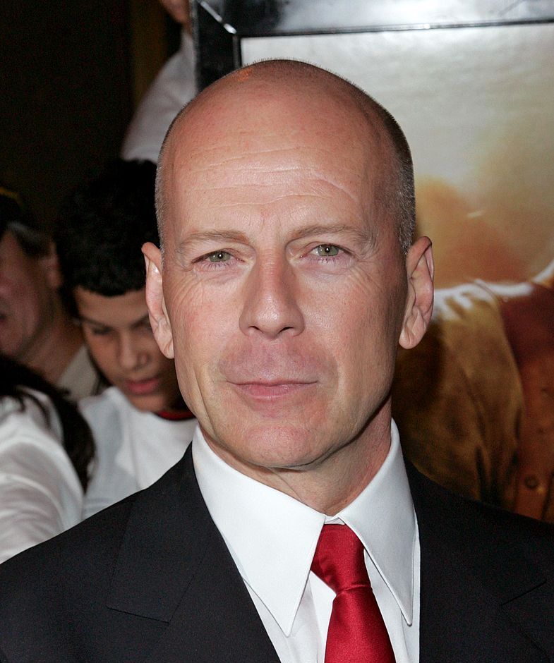 38 Photos of Bald Celebrities When They Had Hair – Bald Actors