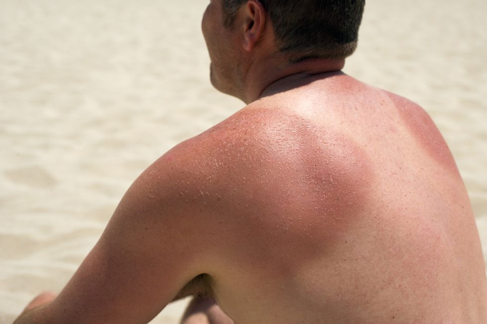 Machines Spot Skin Cancer Better than Doctors