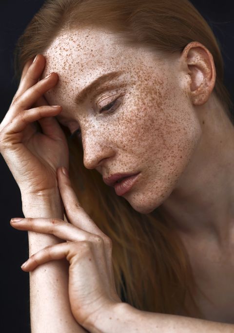 woman freckles sad