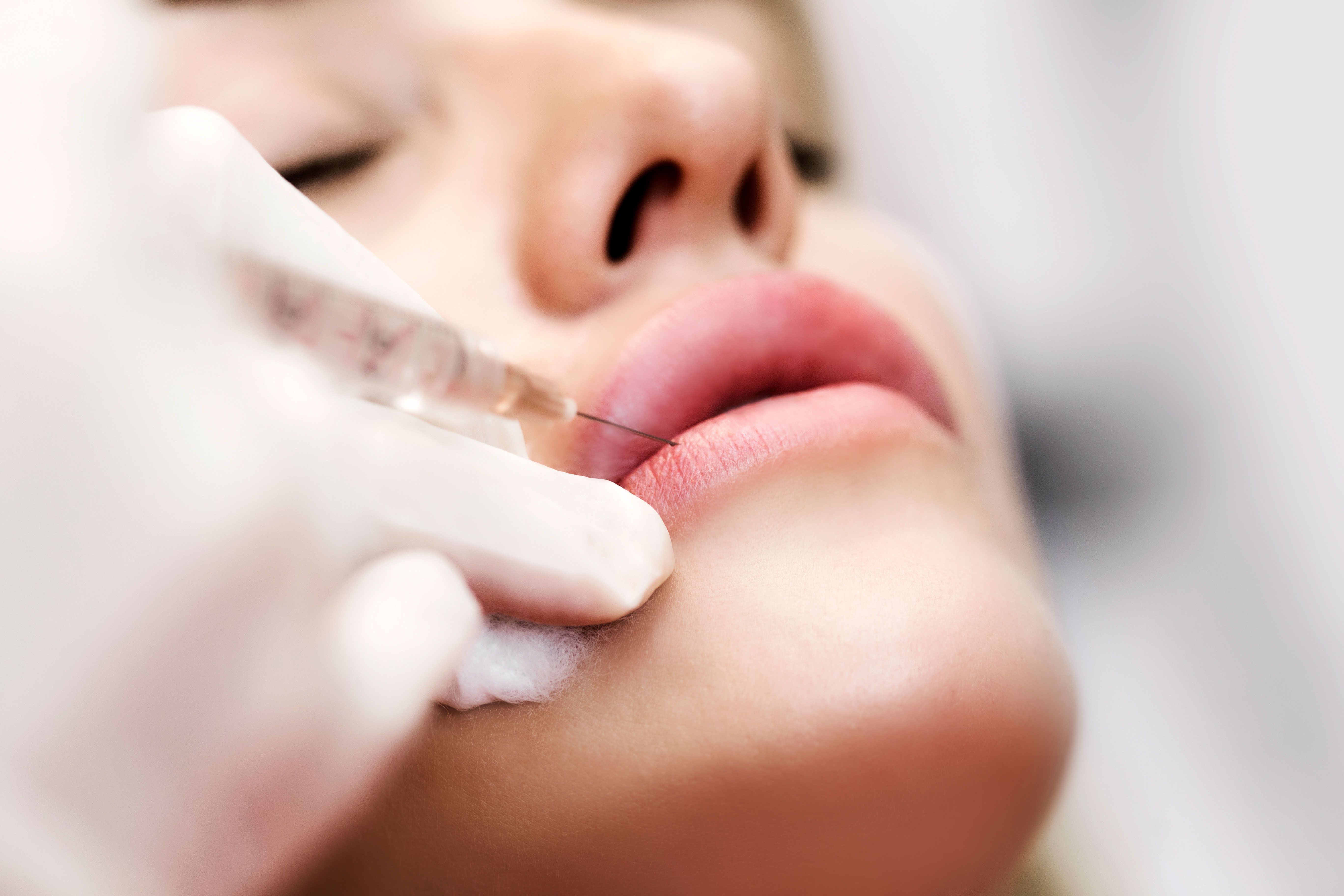 Lip Flip: What It Is, Botox®, Results & Precautions