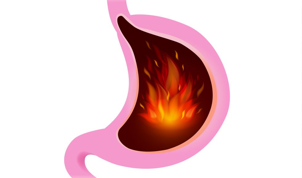 fire inside stomach isolated on white illustration about felling of people with burning sensation from gastritis
