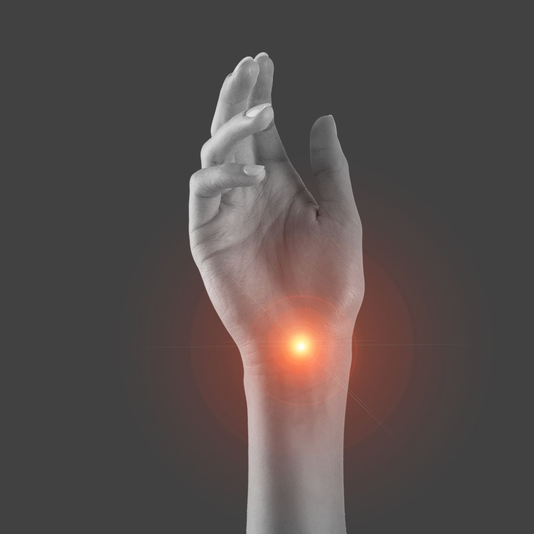 Carpal Tunnel Wrist
