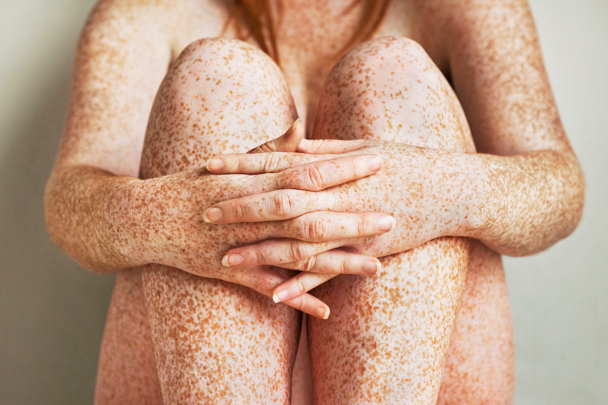 close up of freckled girl's hands folded in front of her legs