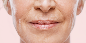 lip wrinkles