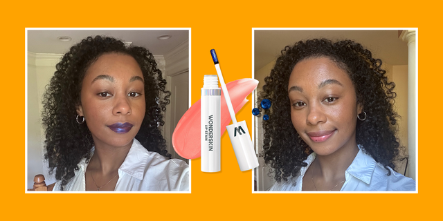 wonderskin review
