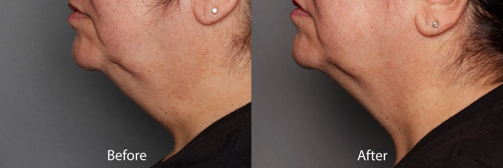 13 best neck firming creams that actually tighten skin, according to lab testing